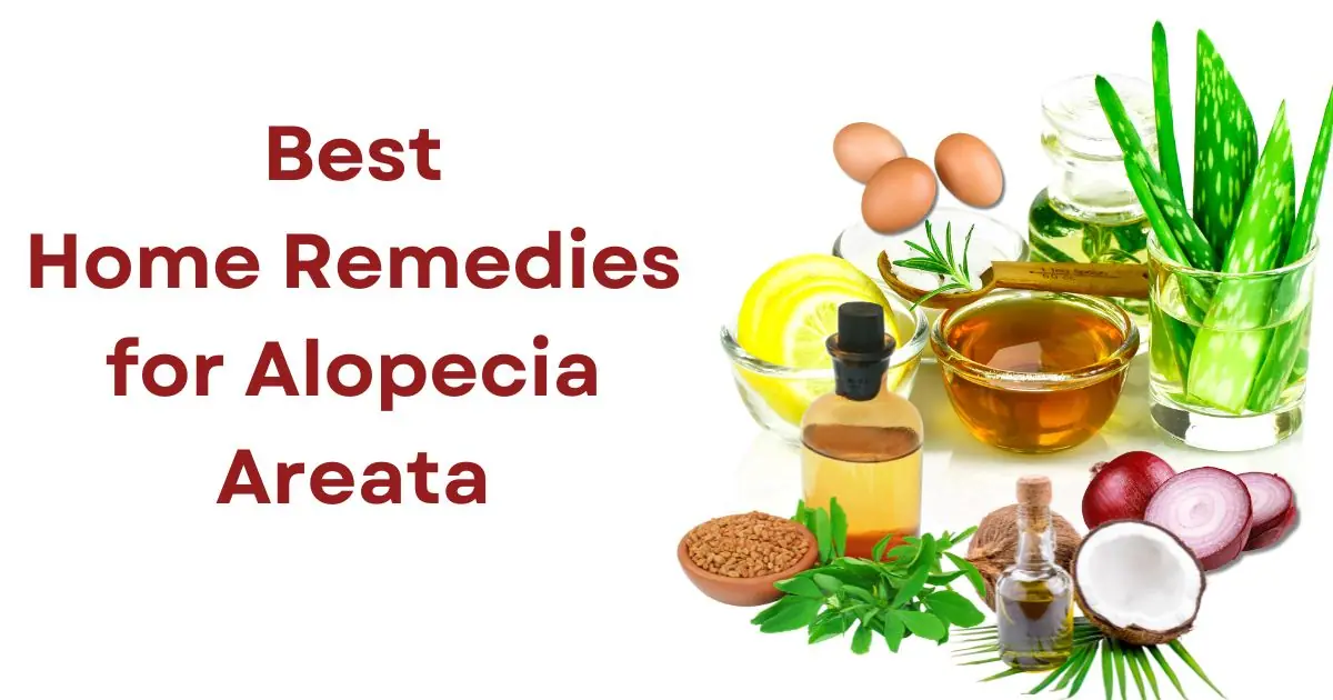 Best home remedies for Alopecia areata - Skinwellhealth.com