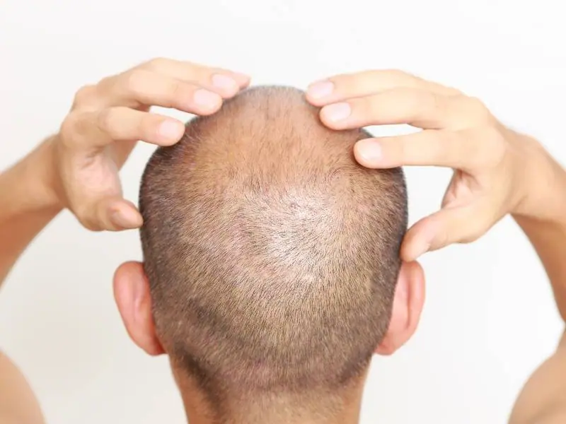 scalp message